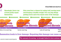 Eighty percent with advanced liver disease in SW are undiagnosed