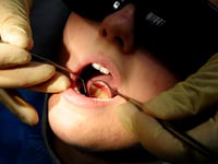 More than a dozen hospital admissions in West Devon to remove children's rotten teeth