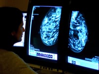 More women in Devon undergo breast cancer screening – as NHS England target met for first in five years