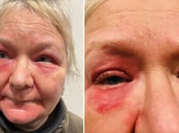 Tavistock woman to sue NHS after brain aneurysm