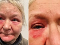 Tavistock woman to sue NHS after brain aneurysm