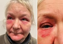 Tavistock woman to sue NHS after brain aneurysm