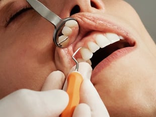 Devon's dental van plan halted