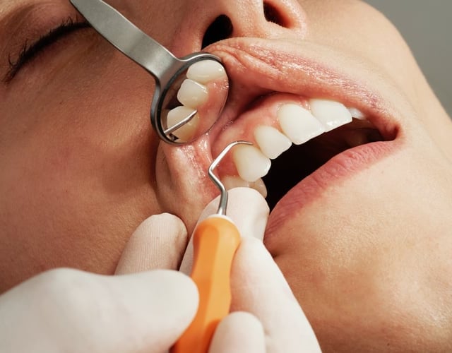 Devon's dental van plan halted